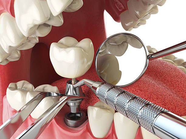 Best Emergency Dental Surgery in Seneca, IL